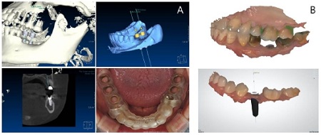 Figure 12.