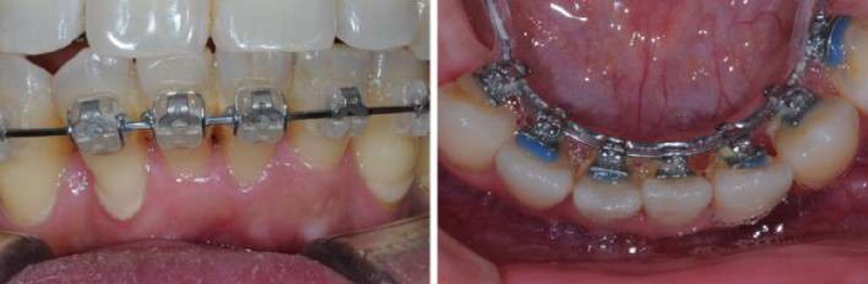 Figure 1. Figure 1.